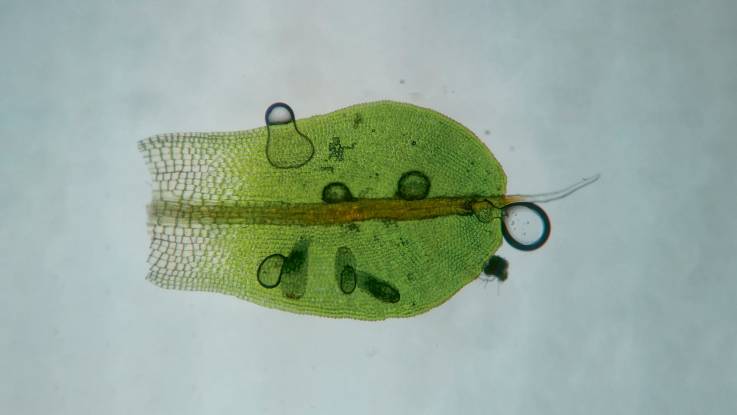 Miskroskopische Aufnahme eines Moosblattes, in das ein Wassertropfen eindringt.